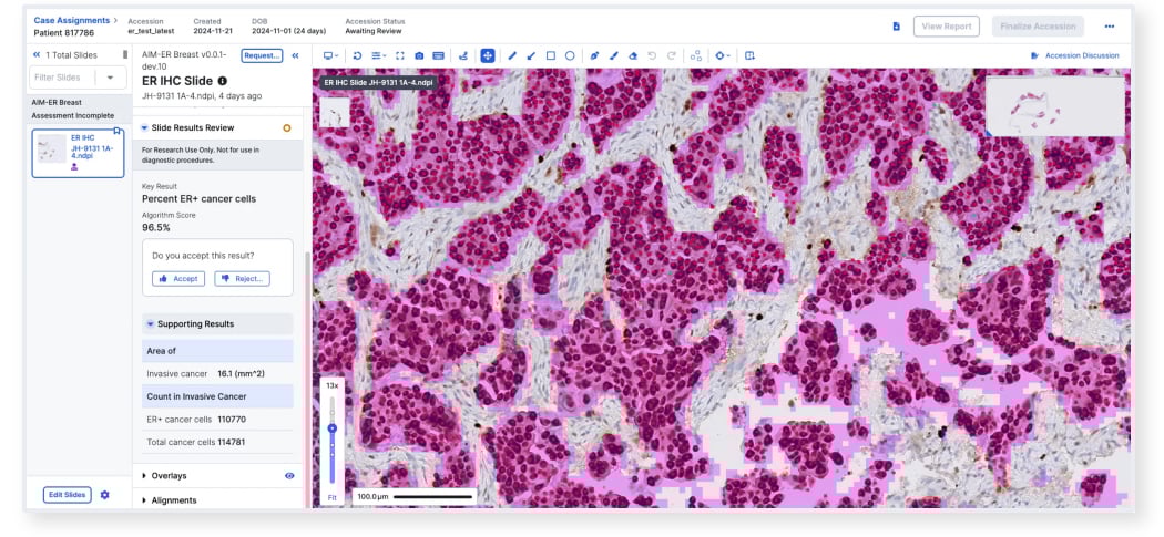 ER-IHC-slide