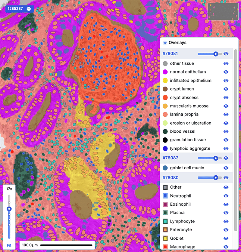 IBD-Explore-cells-800px
