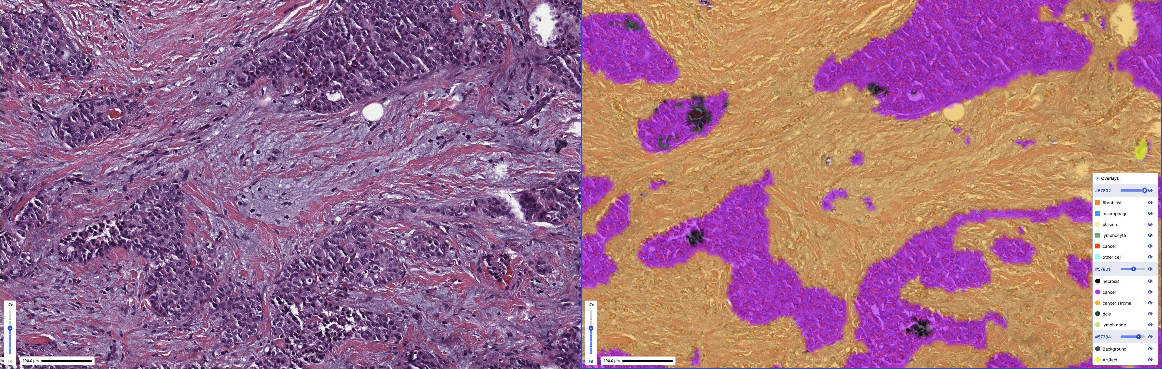 H&E whole slide image with tissue regions and cell types identified and characterized by PathExplore