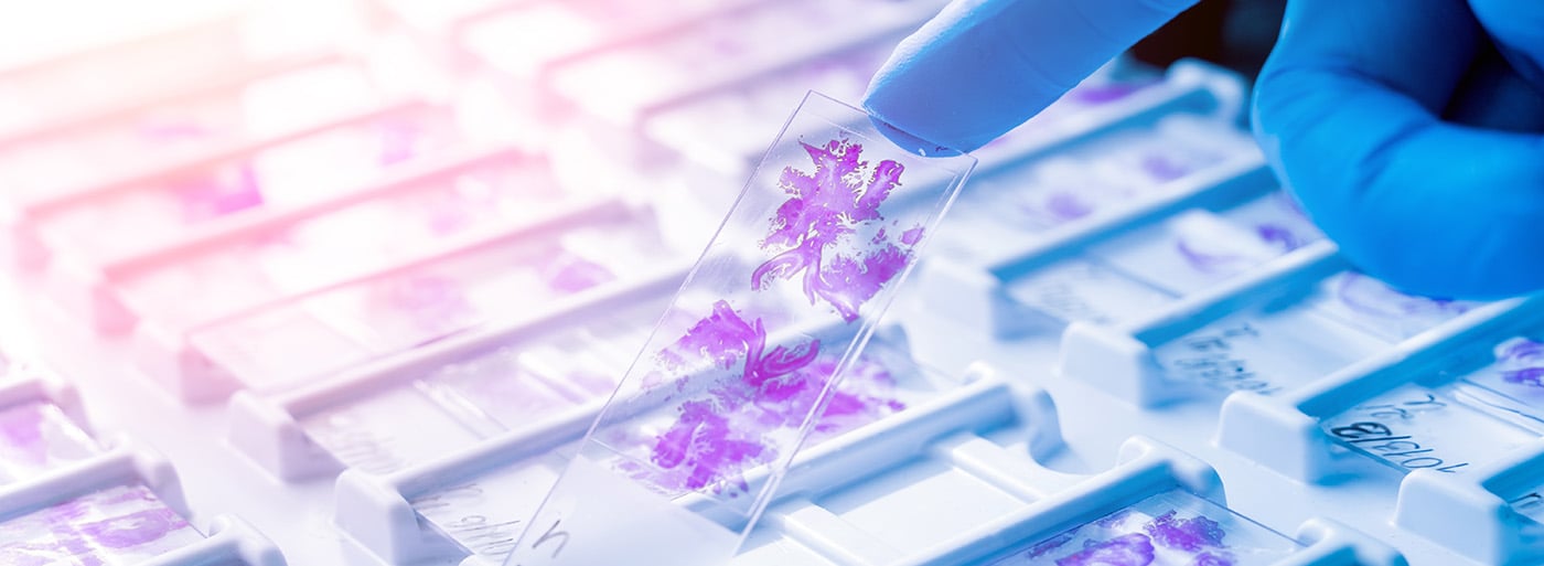 pathology slide with gloved hand