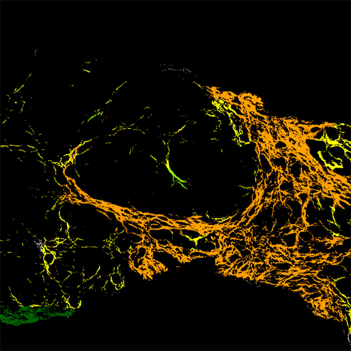 NASH-fibrosis-cells