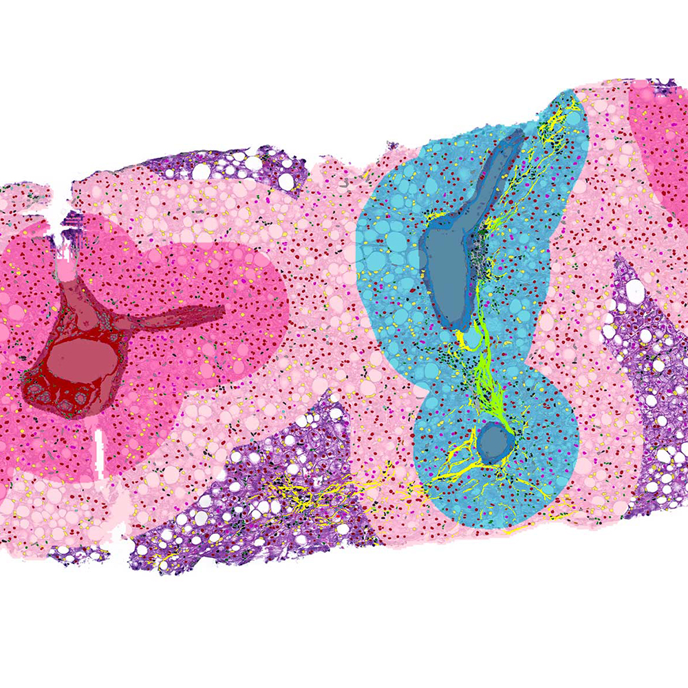 NASH-landmark-cells