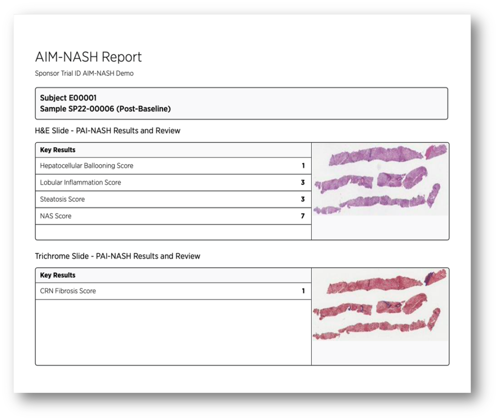 AIM-NASH-report-1024x864