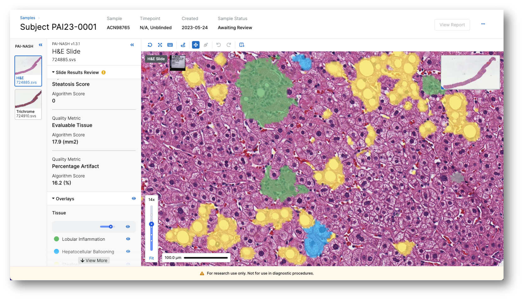AISight-Clinical-Trials-Interface