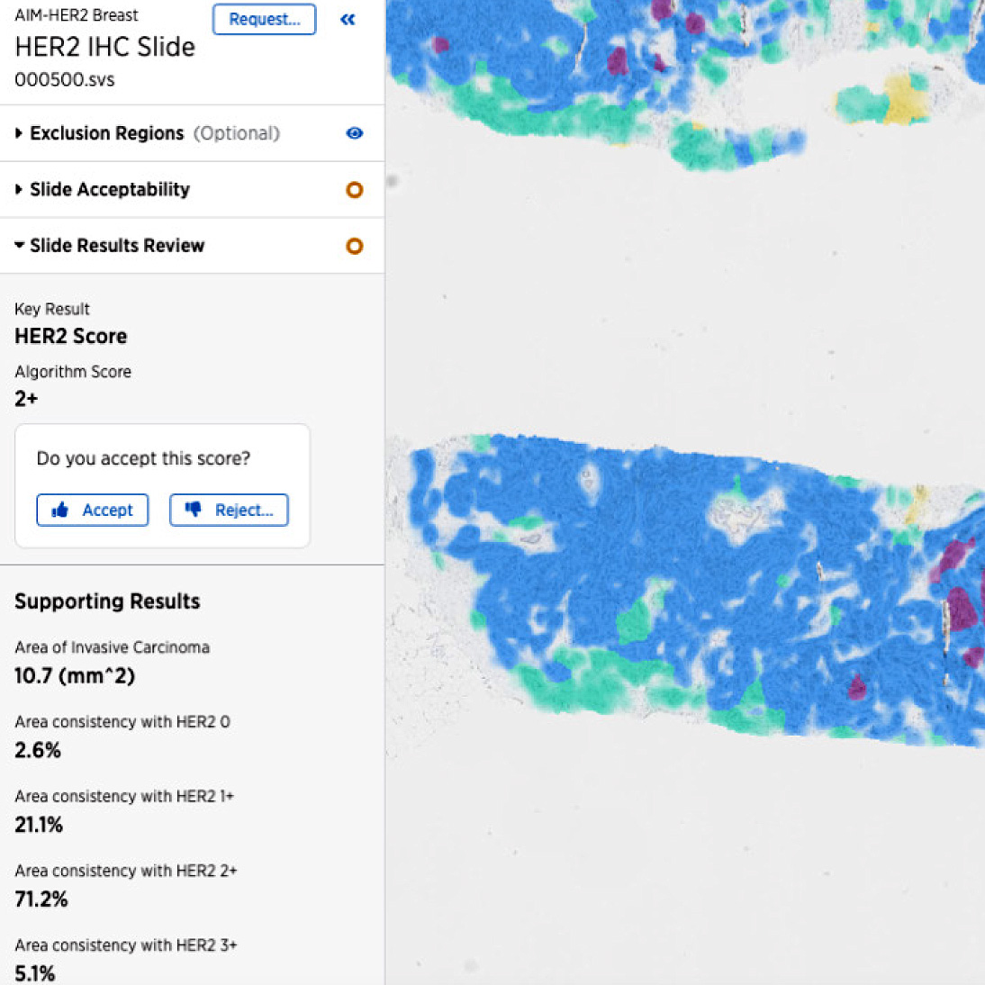 HER2-IHC-slide-platform-view-1