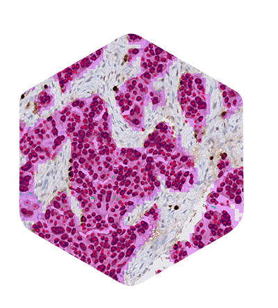 aim-ihc-400w