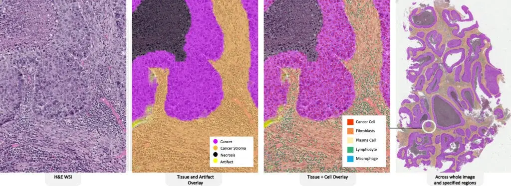 auto-tissue-detection-1024x374-1