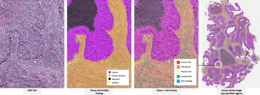 auto-tissue-detection-1024x374