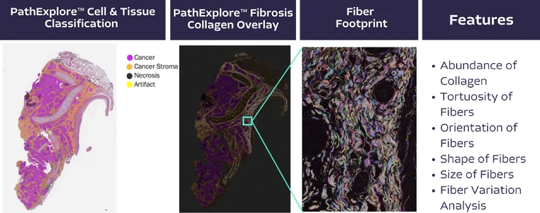 fibrosis-1100px (1)