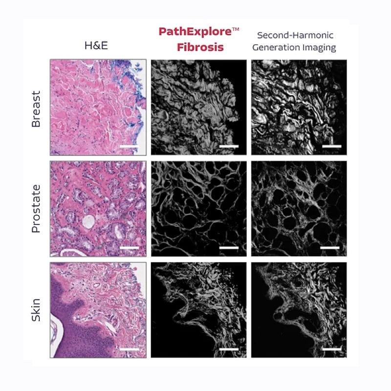 fibrosis-800x800-1