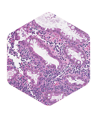 hex-aiproduct-aimhi-400