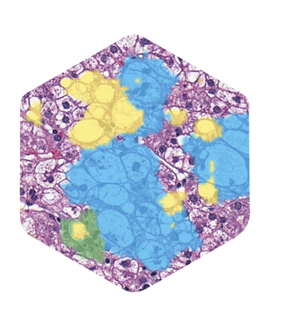 hex-aiproduct-aimnash-400
