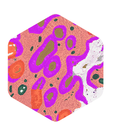hex-aiproduct-ibdexplore-400