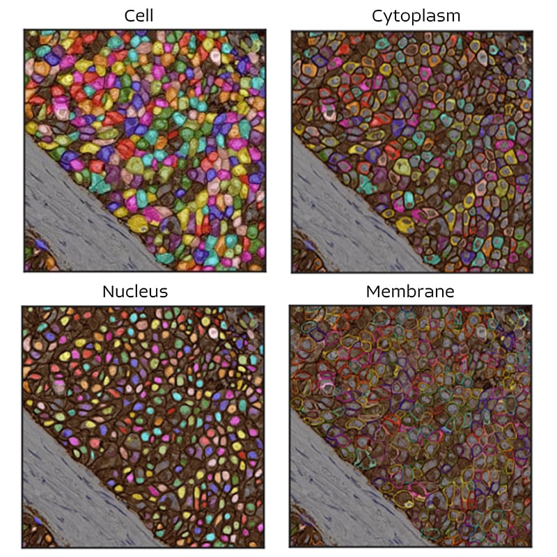 ihc-4-cells