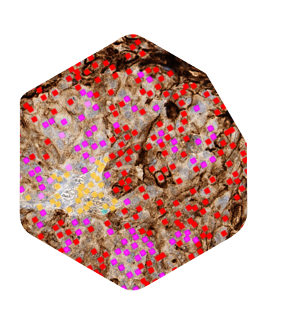 ihc-explore-400w